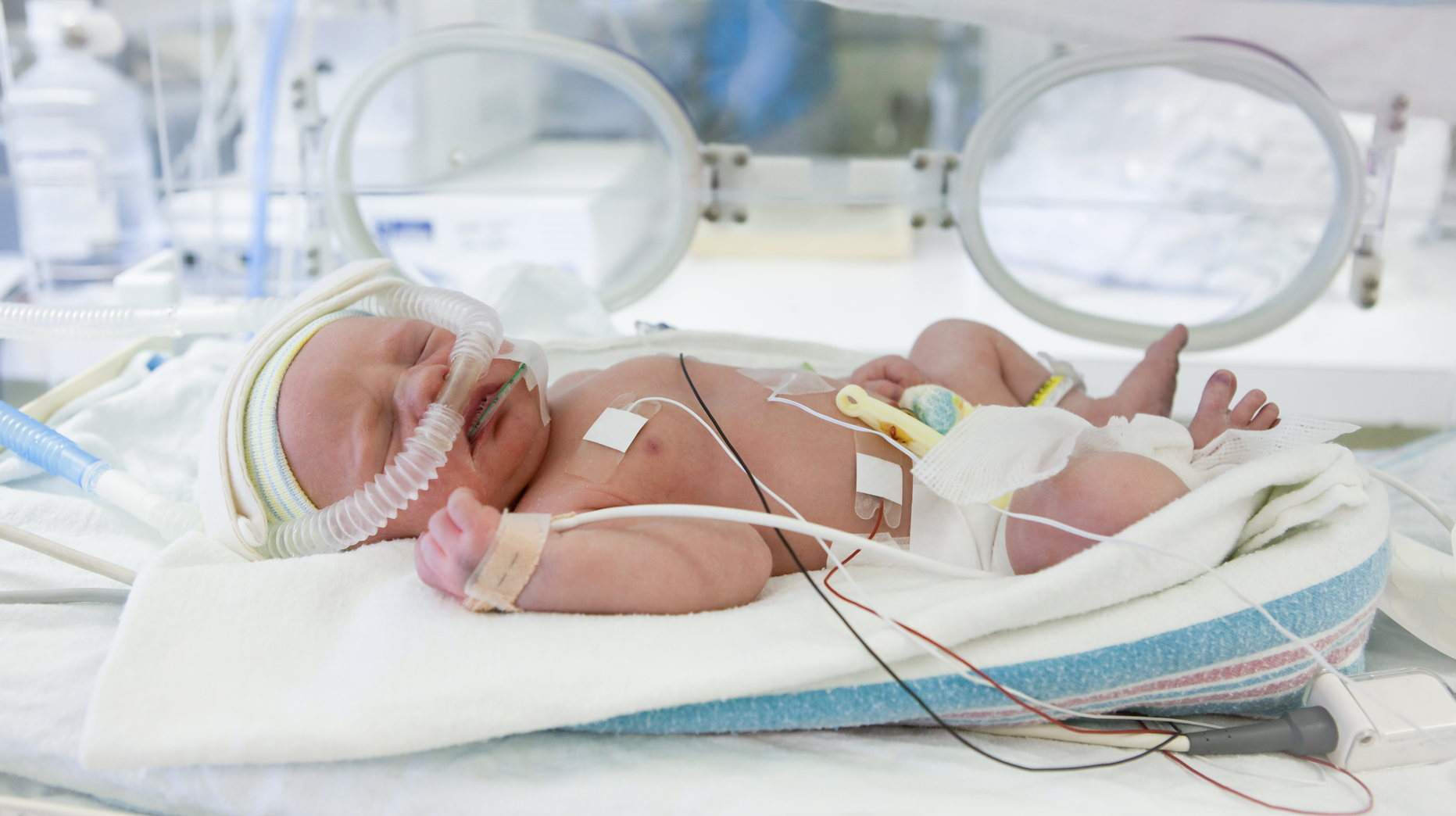 Dreamstime Xxl 123548172 64303b8e4d862