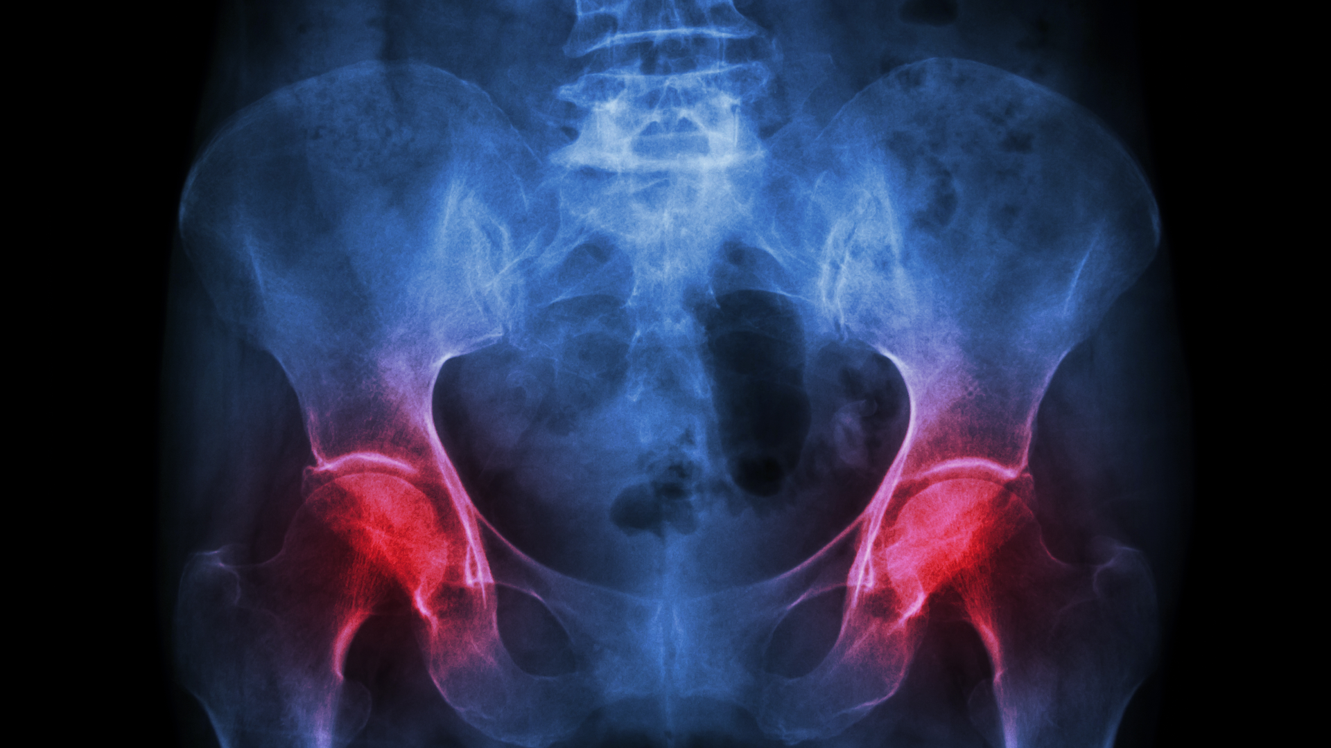 Dreamstime Xxl 48513660 642d7ddf33fa3