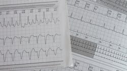 Dreamstime Xxl 212457386 644fc45ea8990 Dreamstime Xxl 212457386 644fc45ea8990