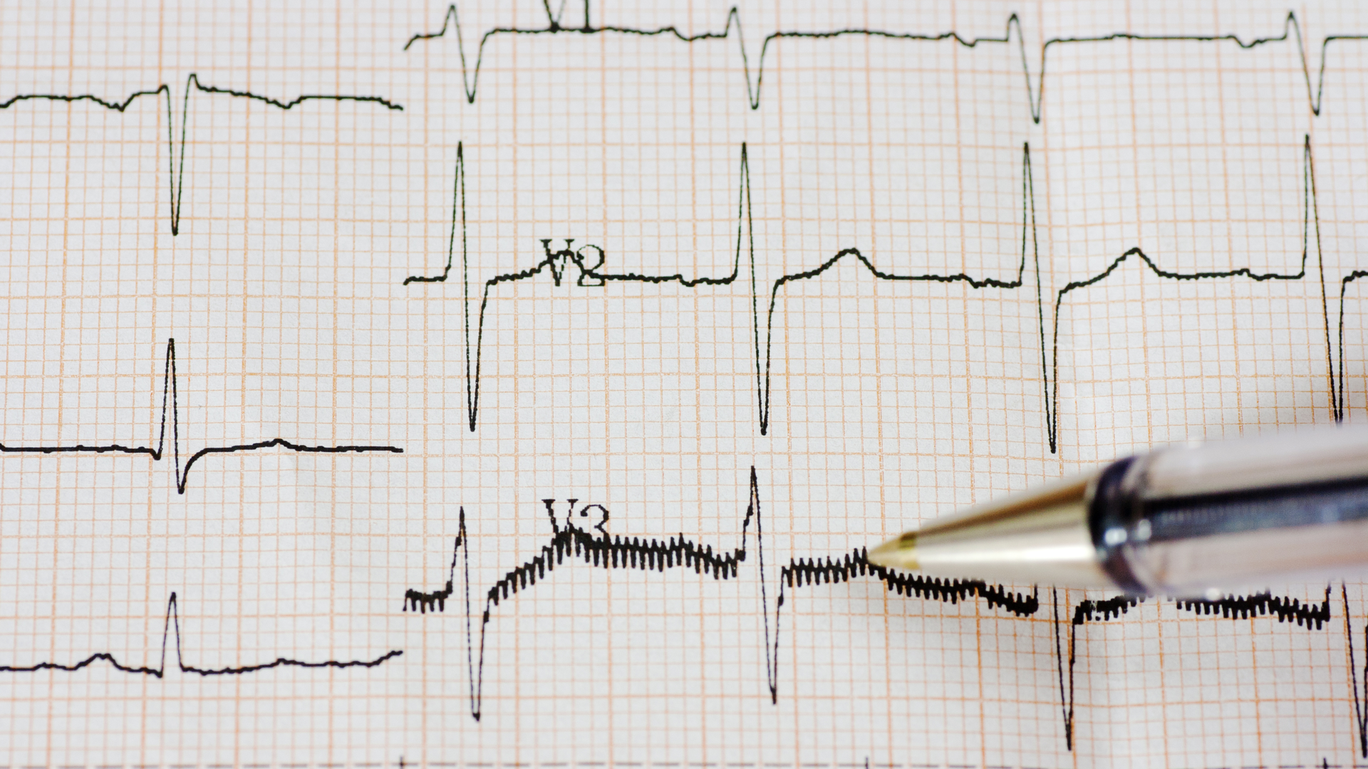 Dreamstime Xxl 30102580 645cef83ecbc4