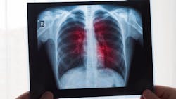 Dreamstime Xxl 175804051 64e5389a72e32 Dreamstime Xxl 175804051 64e5389a72e32