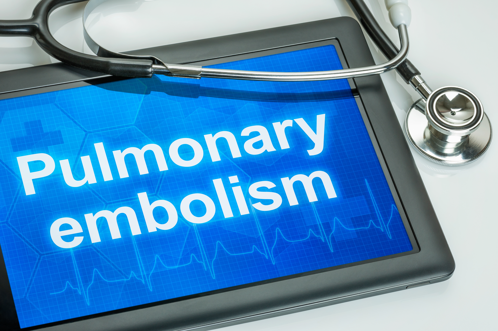 Dreamstime Xxl 98774220 650453b474a16