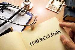 Dreamstime Xxl 93779352 65312f1e60d3a Dreamstime Xxl 93779352 65312f1e60d3a