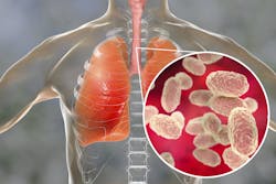 659723e947d93e001f01005d Whooping Cough 659723e947d93e001f01005d Whooping Cough