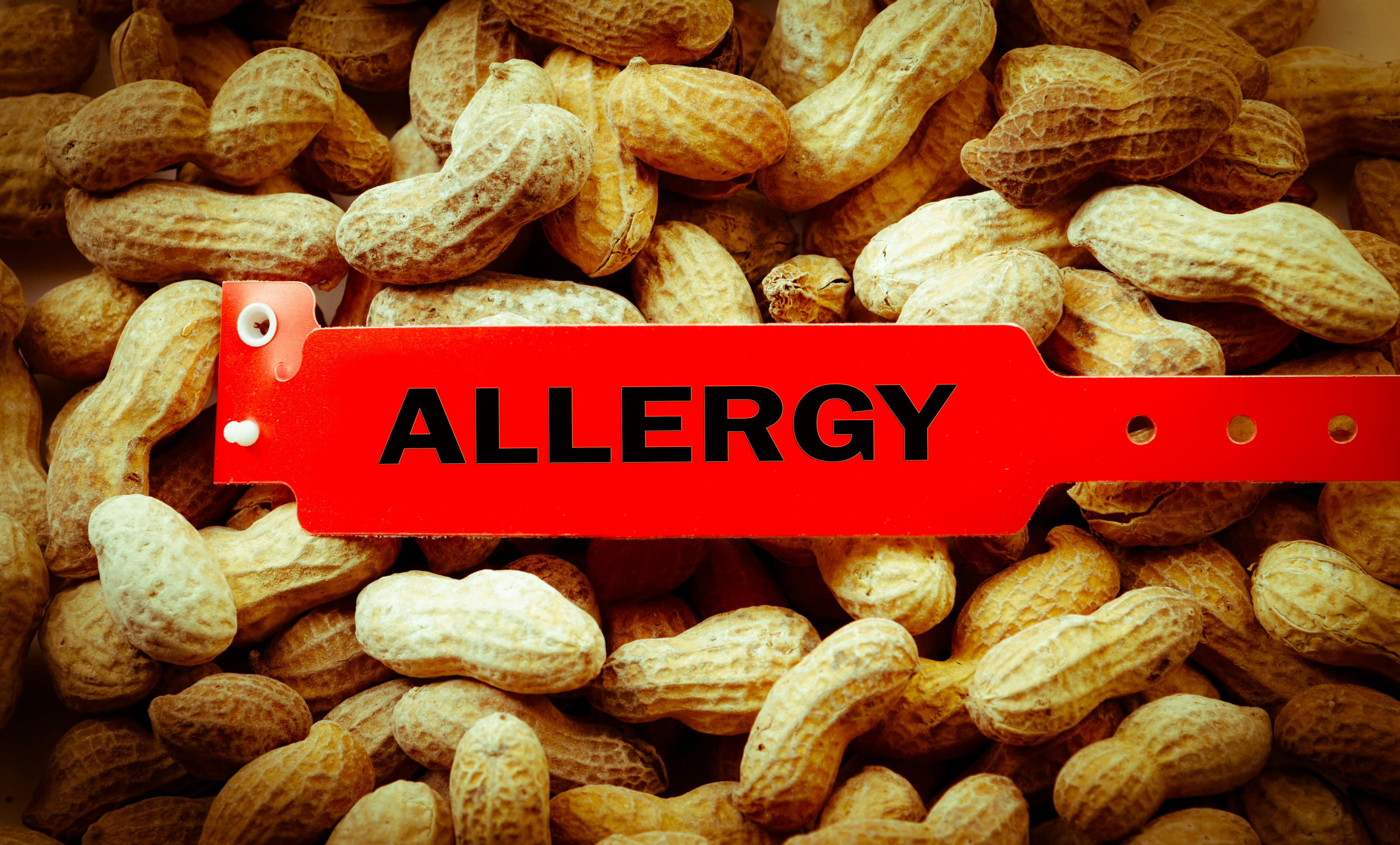 65dcb2ec447522001ed46a0c Peanut Allergy