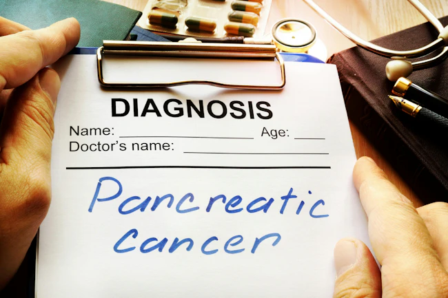 pancreatic_cancer_2
