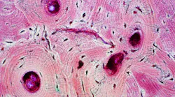 bone_tissue