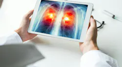 lung_cancer