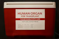 668d659b0f4b1a2fa24e8960 Organ Transplant