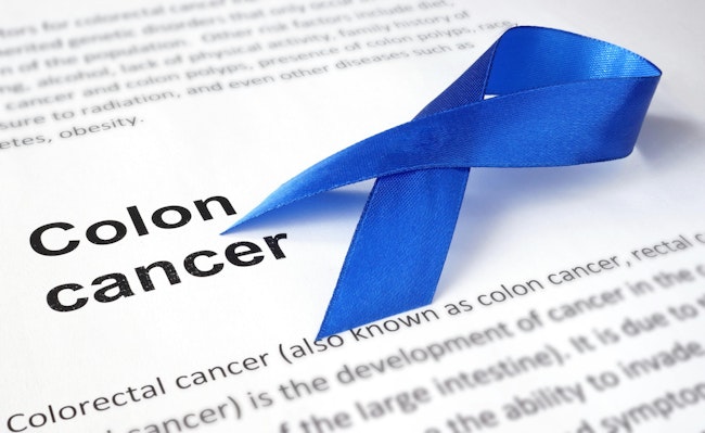 66a8fc873049a81577bd2581 Colon Cancer