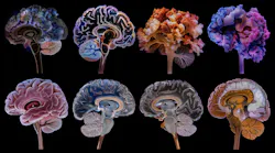 neurodegenerative