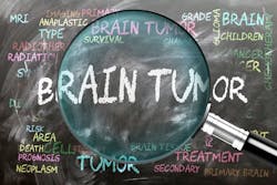 673cd100a92c3d33e679ed79 Brain Tumor 673cd100a92c3d33e679ed79 Brain Tumor