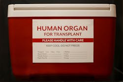 674622e63ccde91caa13c822 Organ Transplant 674622e63ccde91caa13c822 Organ Transplant