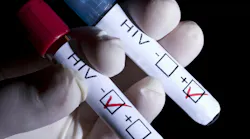 hiv_2