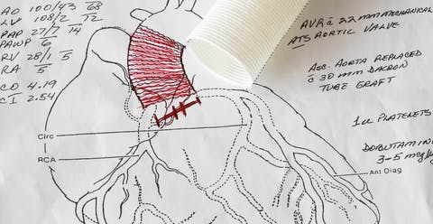 67b6102865c82c2f92f6e3c7 Heart Surgery