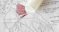 heart_surgery