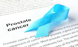 686ea2ae0836d8472e5b8a79 Prostate Cancer 2 686ea2ae0836d8472e5b8a79 Prostate Cancer 2