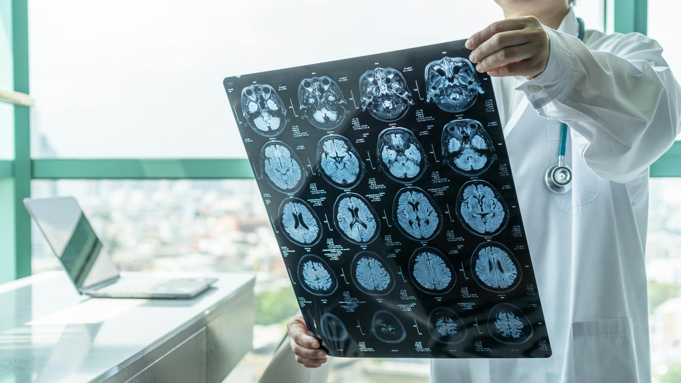 68714c887fb68cb27f1122a3 Neurological Disease