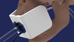 mouthguard_01 mouthguard_01