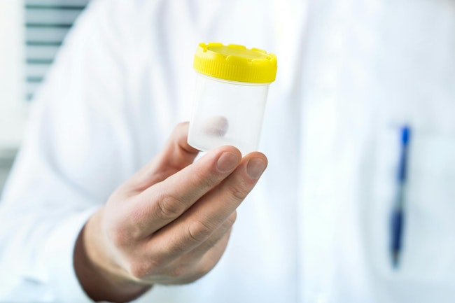 68ed3cdaed0a570940130ce7 Medical Test