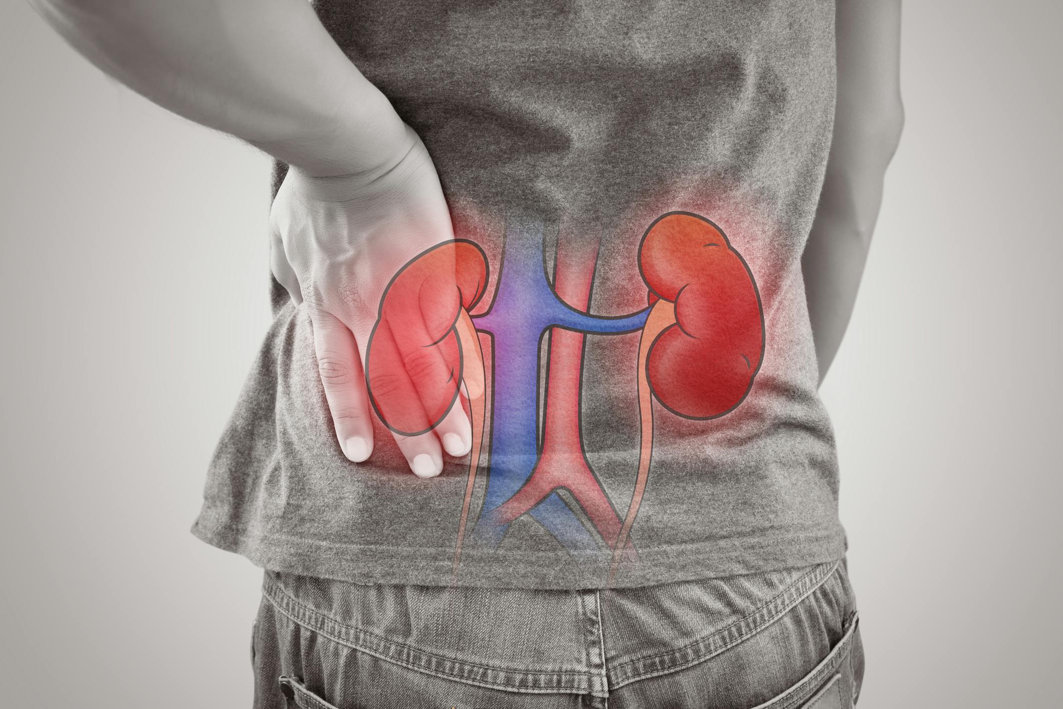 68ff9984245c6e50a1aea78a Kidney Cancer