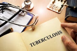 691f5fc3db7f3e3daa5163b4 Tuberculosis 691f5fc3db7f3e3daa5163b4 Tuberculosis