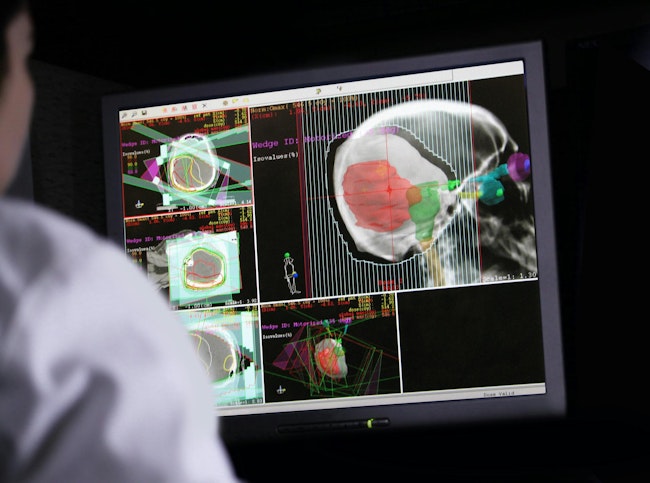 695ea3eb91ecc11617a74dc7 Brain Cancer