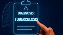 tuberculosis_2