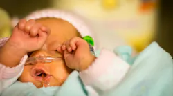 NICU