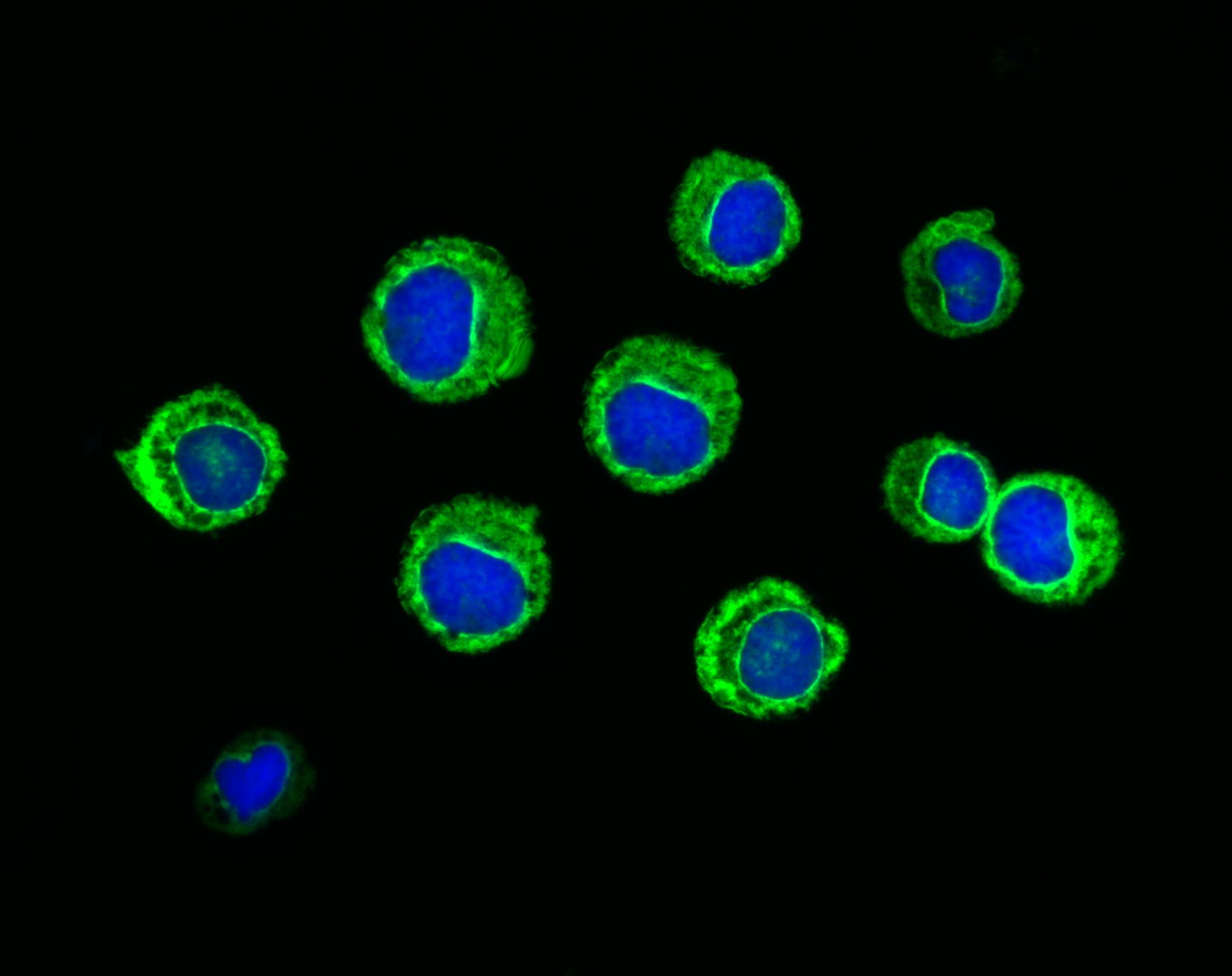 6a0de49452015378ce568401 Leukemia