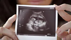 ultrasound_2
