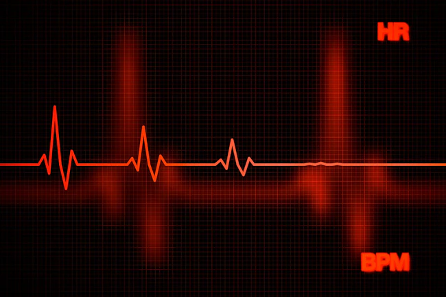 6a63b02bec8db0513e62782f Heart Failure
