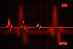 6a63b02bec8db0513e62782f Heart Failure