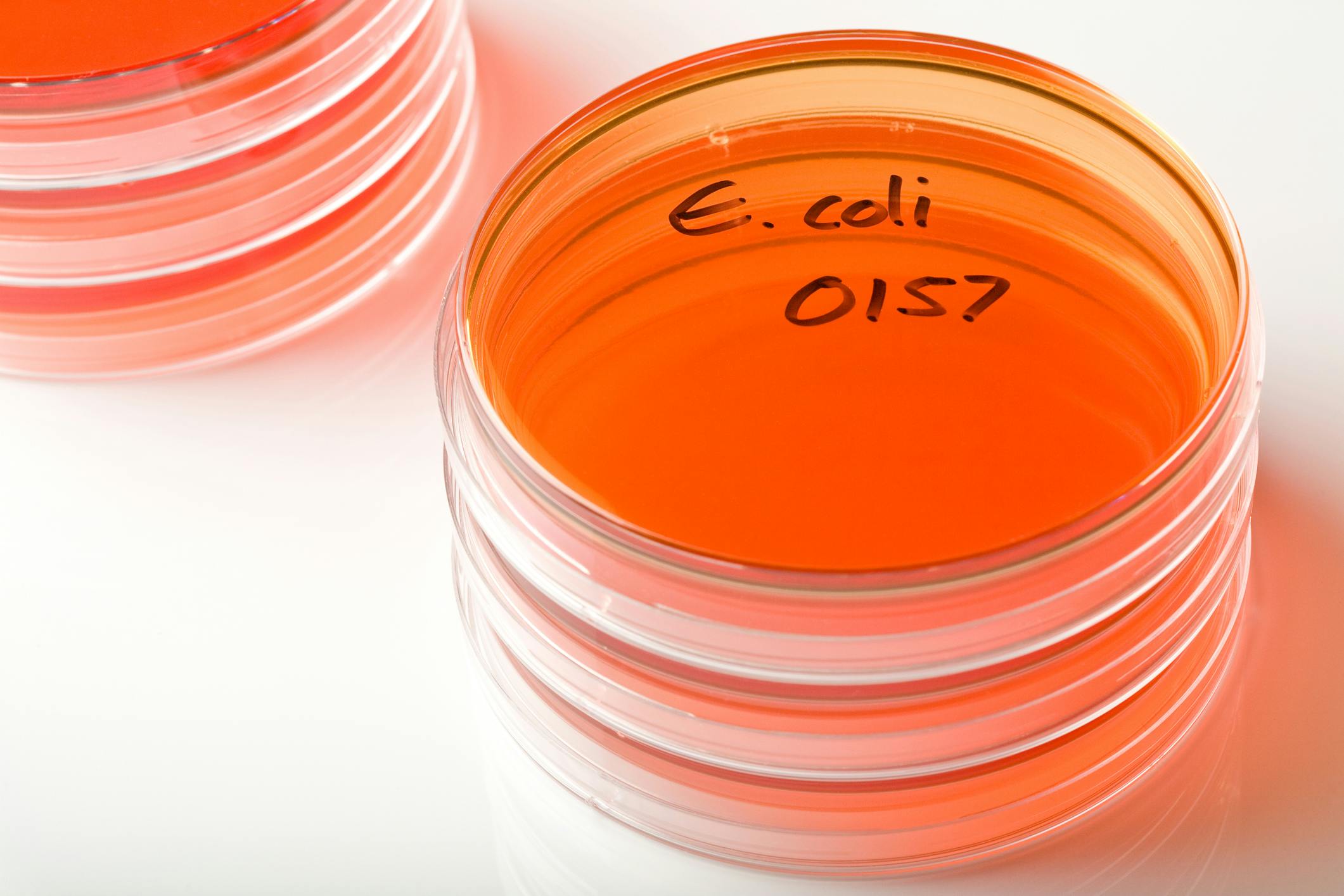 6a720f4e0cc6882ffa6ebb17 E Coli