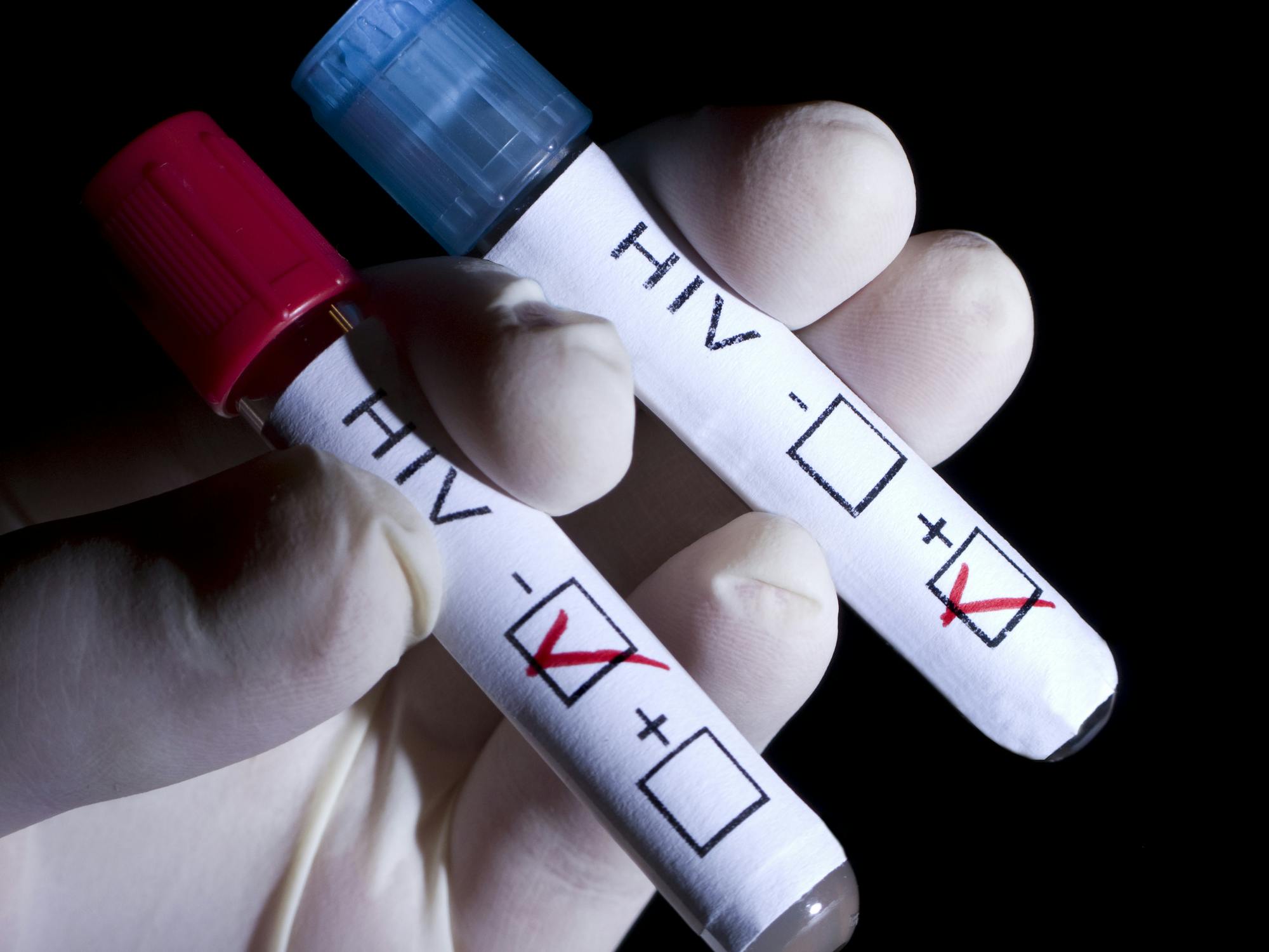 hiv