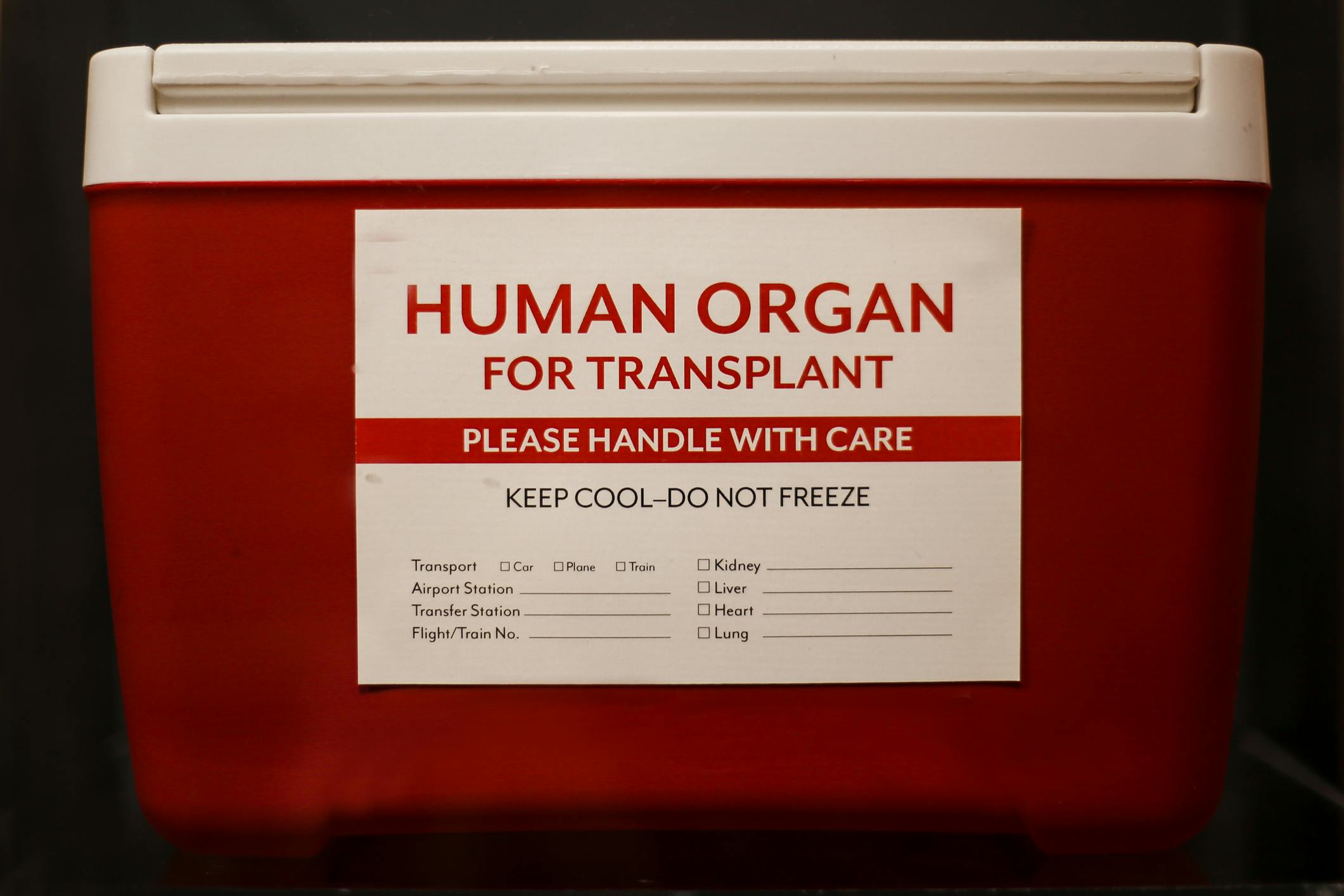 6a98758dc7bb981b15dd7394 Organ Transplant