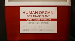 organ_transplant