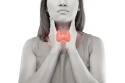 6aa05c579f770521aca1b7e7 Thyroid Cancer