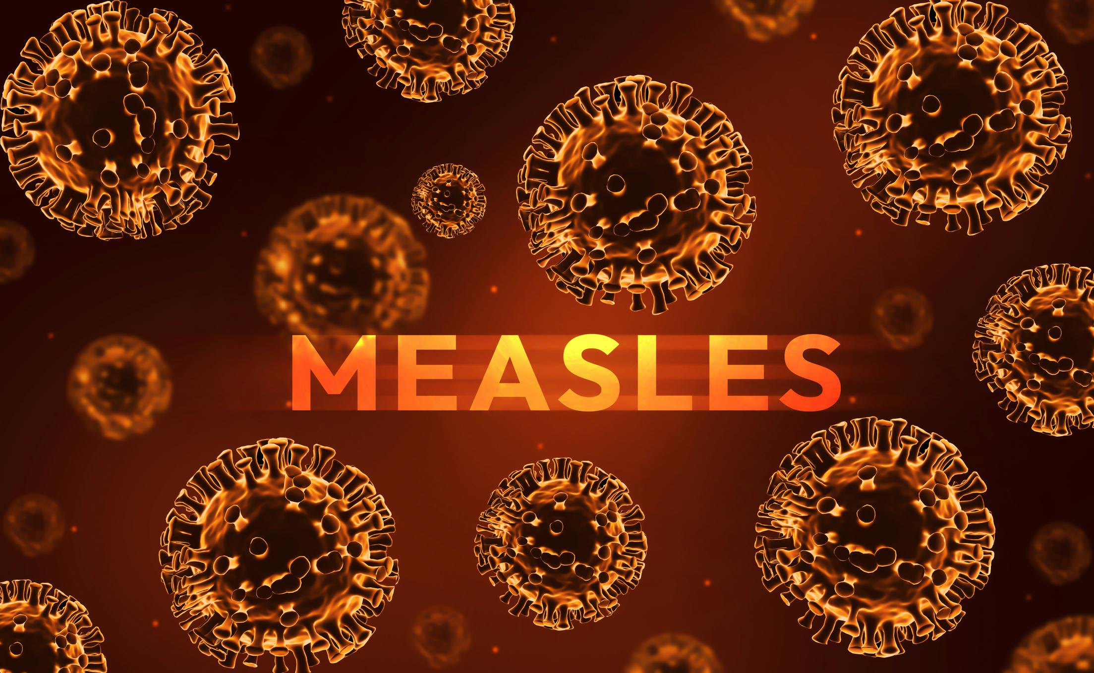 6aaaba7a26d361f9e2d9694c Measles 2