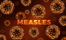 6ad639d9626adb45ebe33ca0 Measles 2