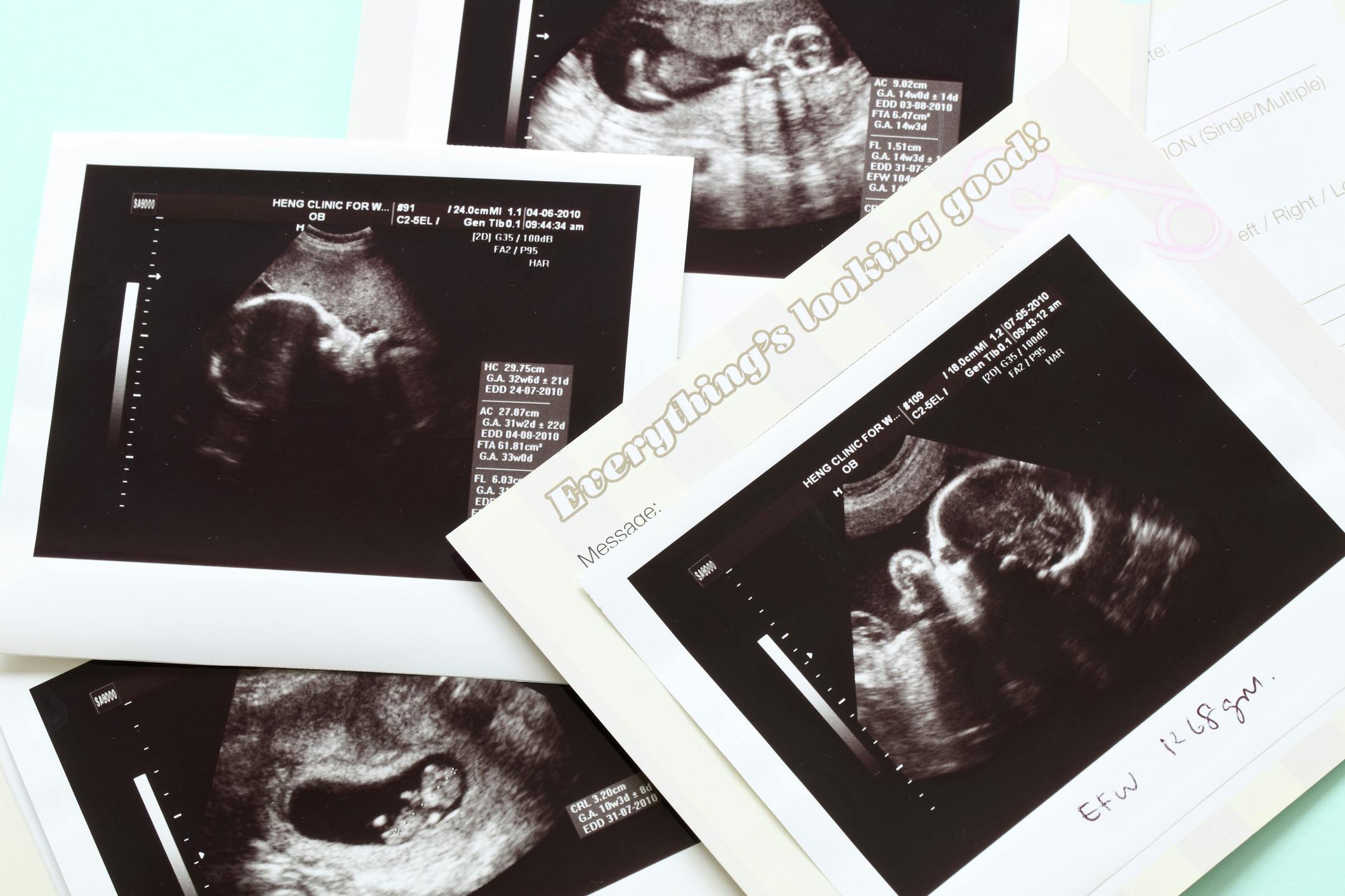 6ae0f771a77aed025a86b53a Childbirth